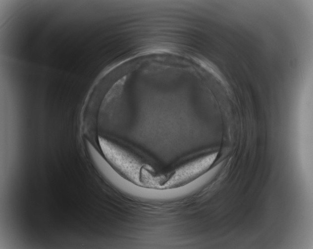 X0000087611226200705251935