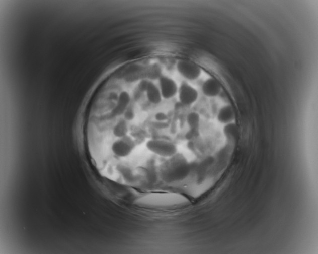 X0000087611235200705251936