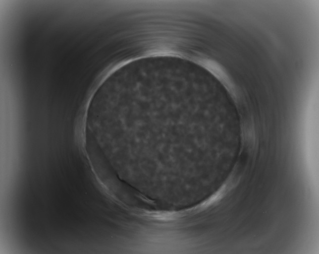 X0000087611244200705251936