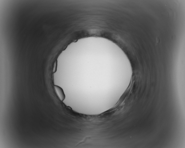 X0000087611249200705251935