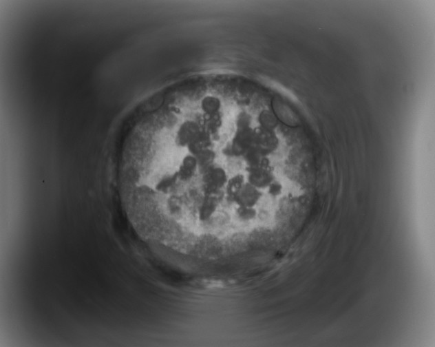 X0000087611255200705251935