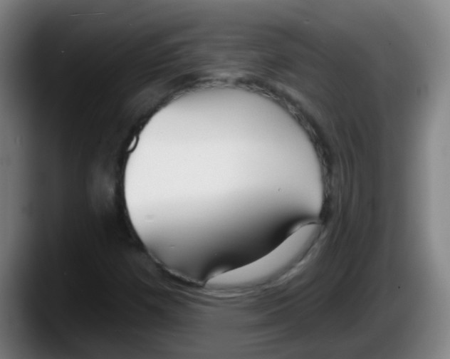 X0000087611257200705251935