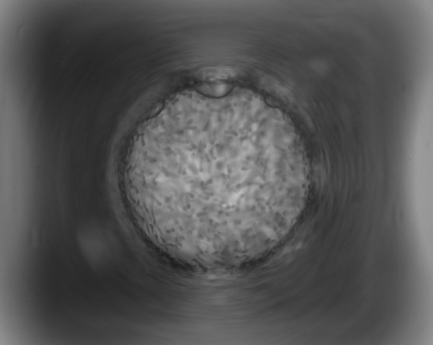 X0000087611393200705251933