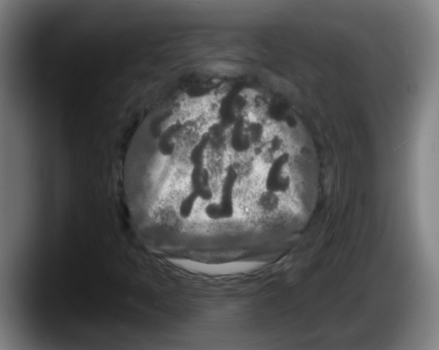 X0000087611397200705251933