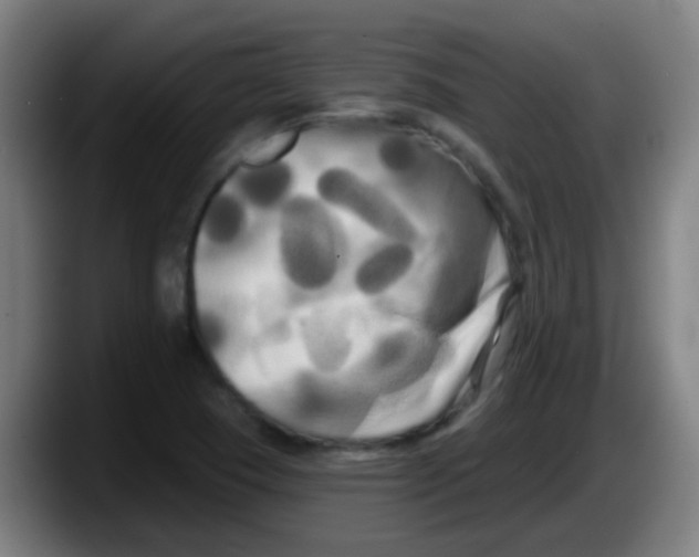 X0000087611409200705251933