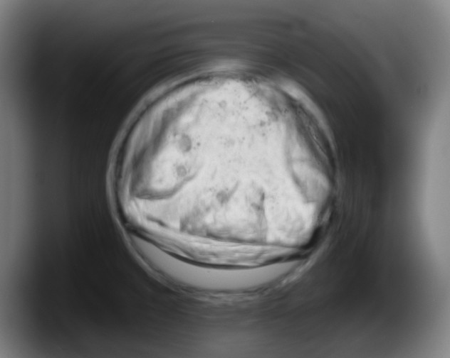 X0000087611429200705251933