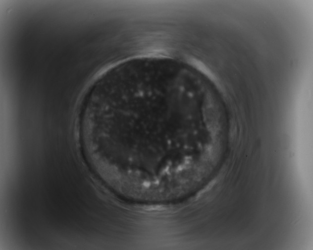 X0000087611455200705251932