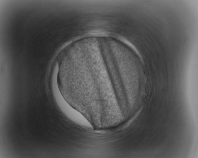 X0000087611461200705251932