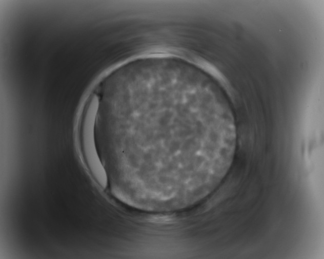 X0000087611472200705251932