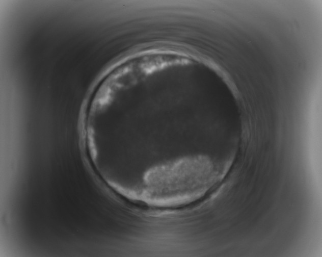 X0000087611522200705251932