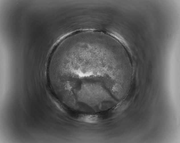 X0000087620155200704271405