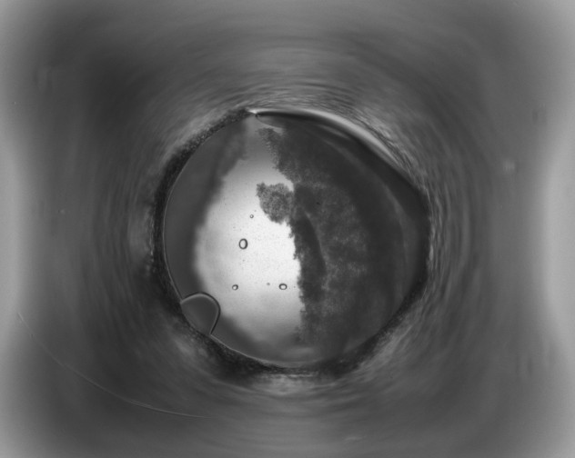 X0000087620303200704271403