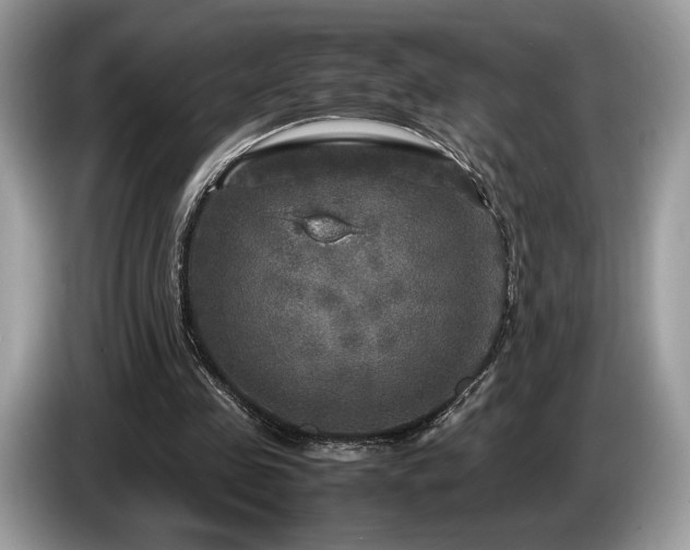 X0000087620341200704271402
