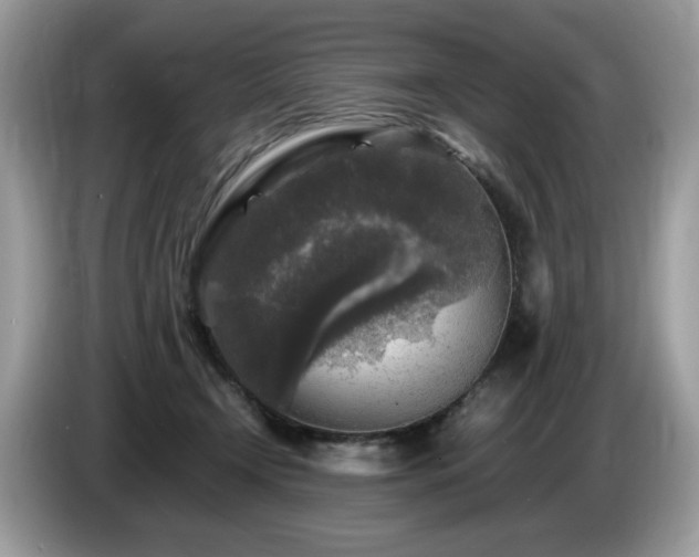 X0000087620366200704271403
