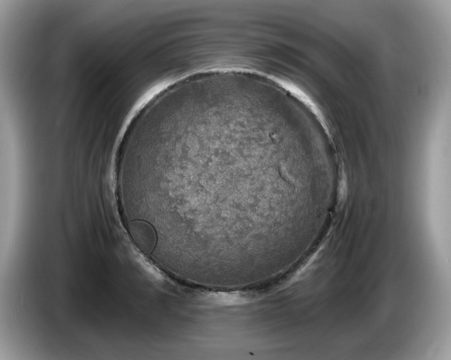 X0000087620990200704271355