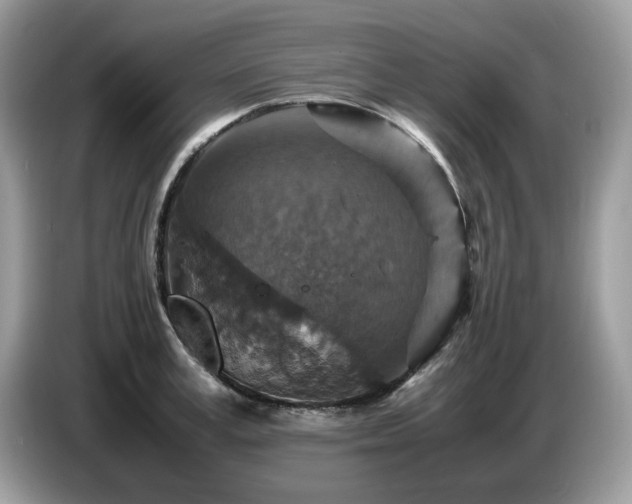 X0000087620995200704271355