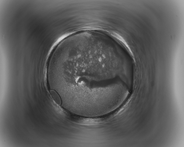 X0000087621179200704271353