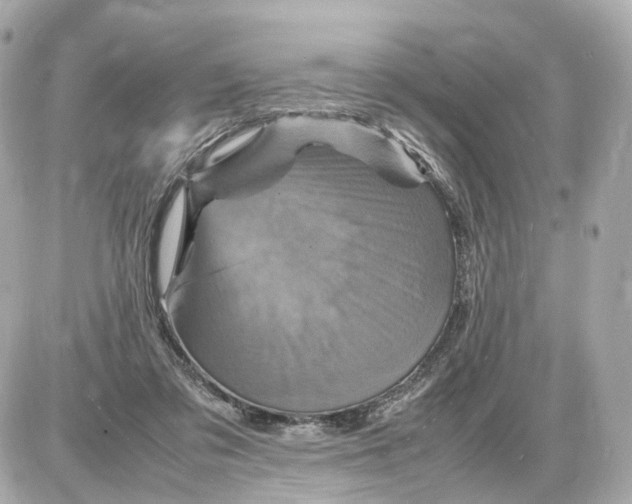 X0000087620309200705120025