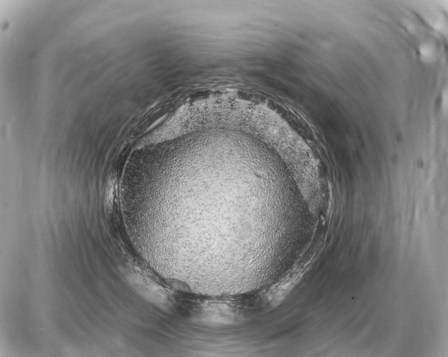 X0000087620574200705120021