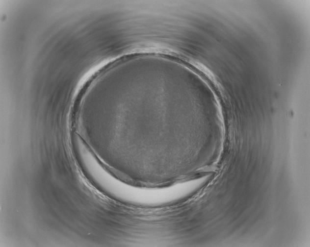 X0000087621120200705120011