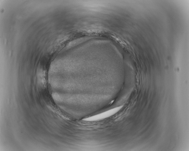 X0000087621156200705120011