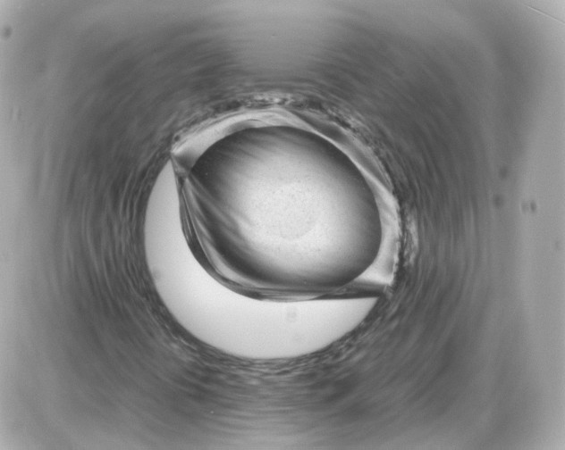X0000087621394200705120006
