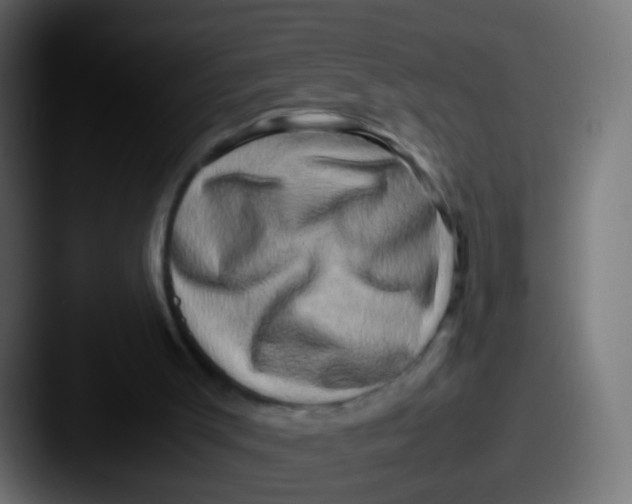 X0000087620003200705181321