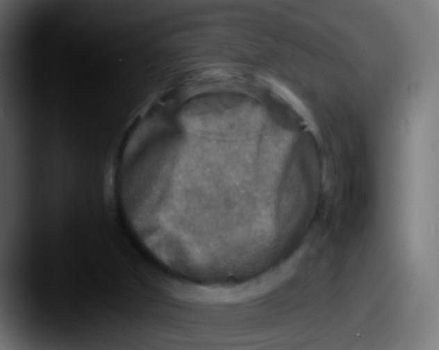 X0000087620010200705181321