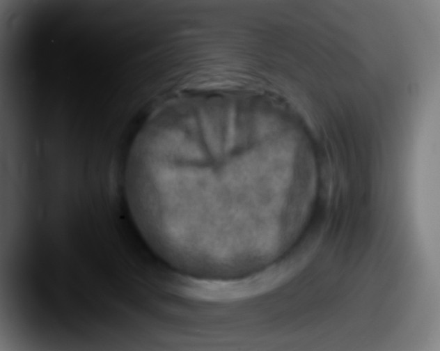 X0000087620034200705181321