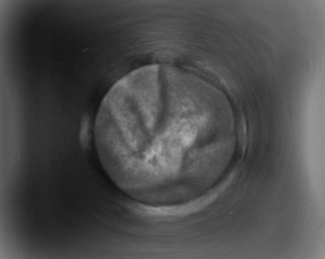 X0000087620038200705181321