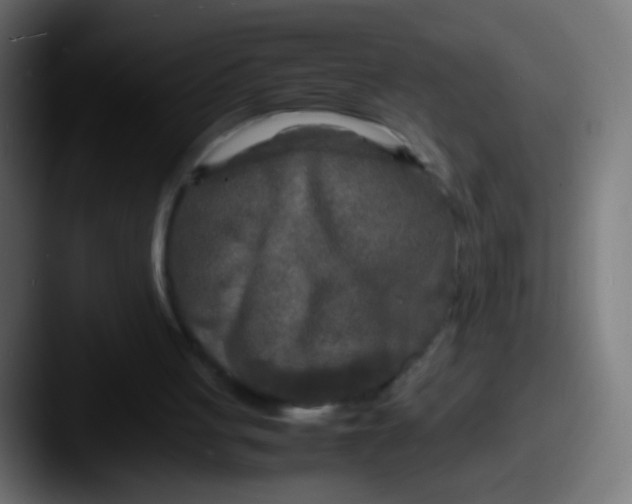 X0000087620051200705181320