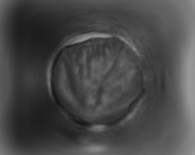 X0000087620055200705181320