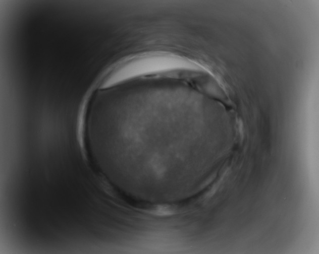 X0000087620056200705181320