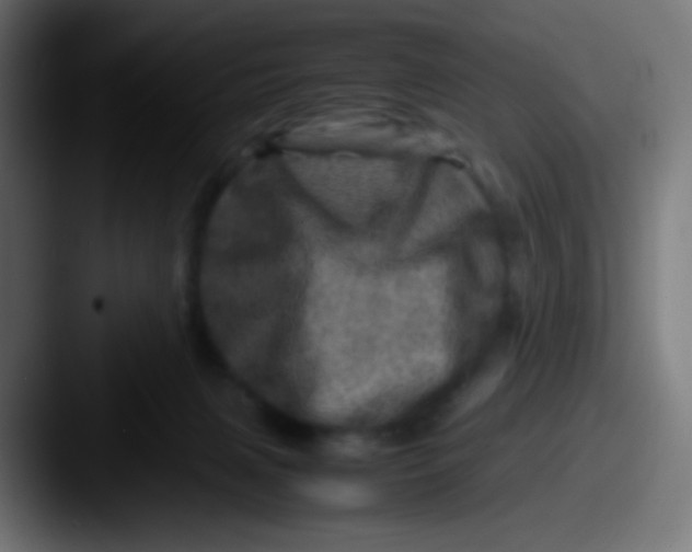 X0000087620079200705181320