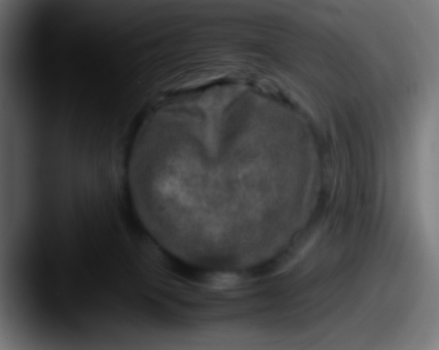 X0000087620085200705181320