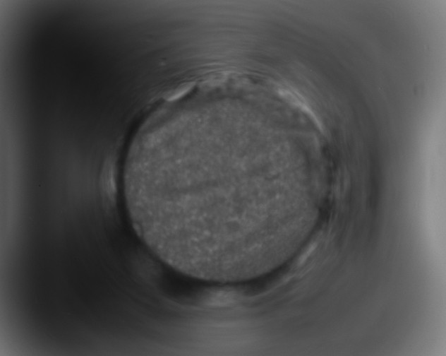 X0000087620115200705181320