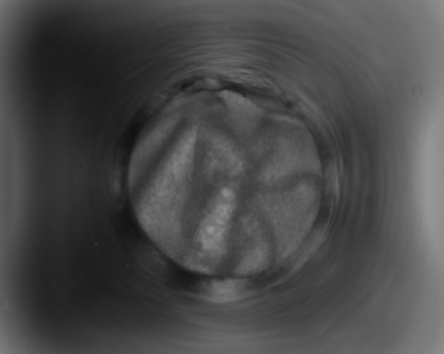 X0000087620134200705181320