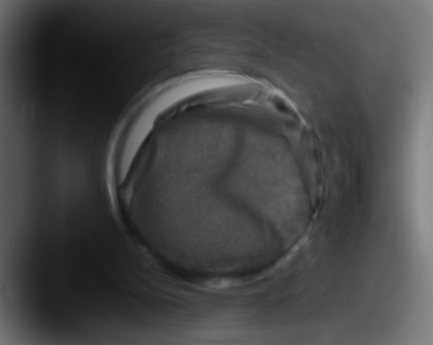 X0000087620152200705181319