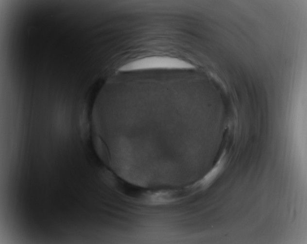 X0000087620186200705181319
