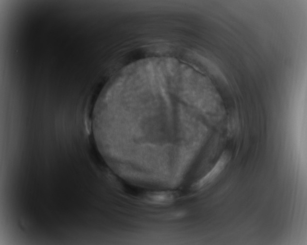 X0000087620187200705181319
