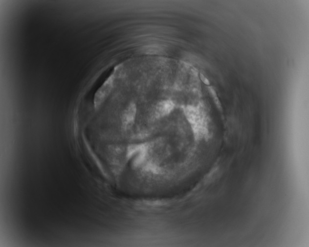 X0000087620194200705181319