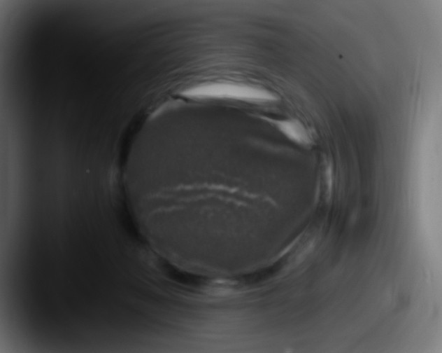 X0000087620222200705181319