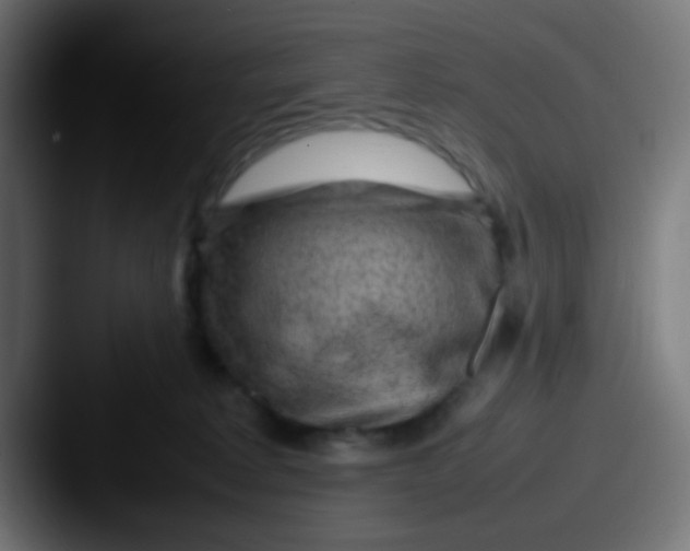 X0000087620229200705181318