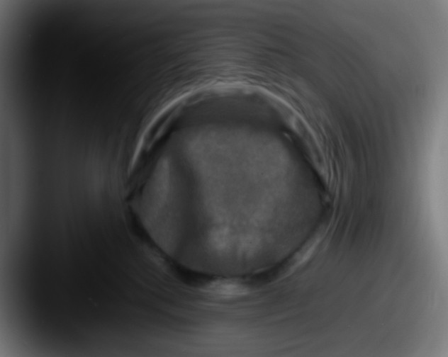 X0000087620280200705181318