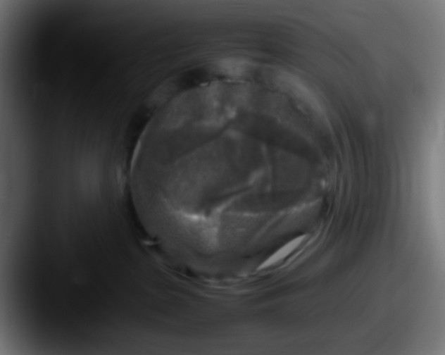 X0000087620285200705181318