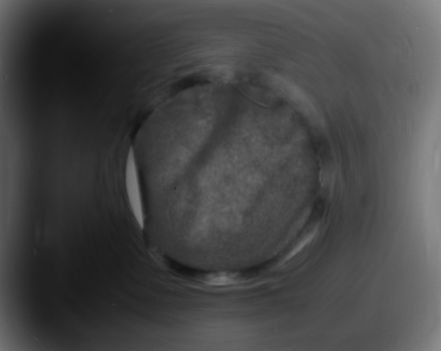 X0000087620335200705181317