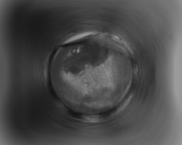 X0000087620359200705181317