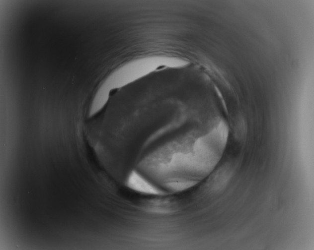 X0000087620366200705181317