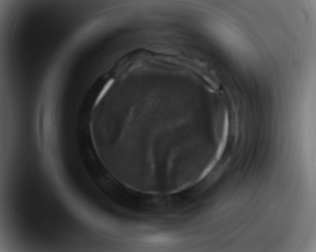 X0000087620383200705181317