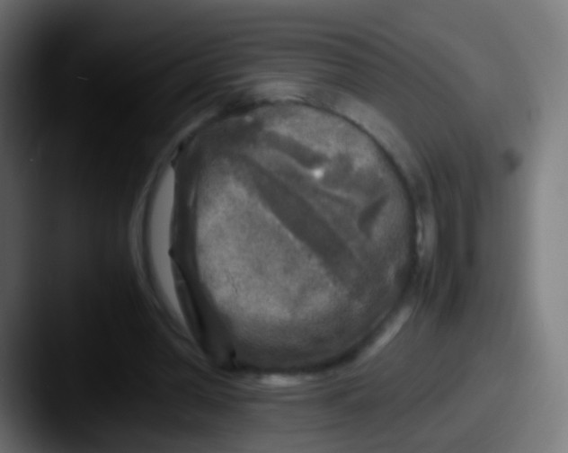 X0000087620390200705181317